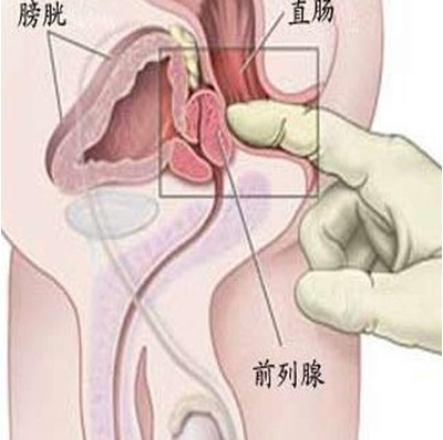 男性<em>小腹疼痛是怎么回事</em>_上海宏康医院男科