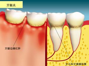 4-160R920255J51.jpg