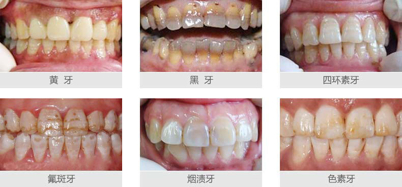 2-160R91K1201S.jpg